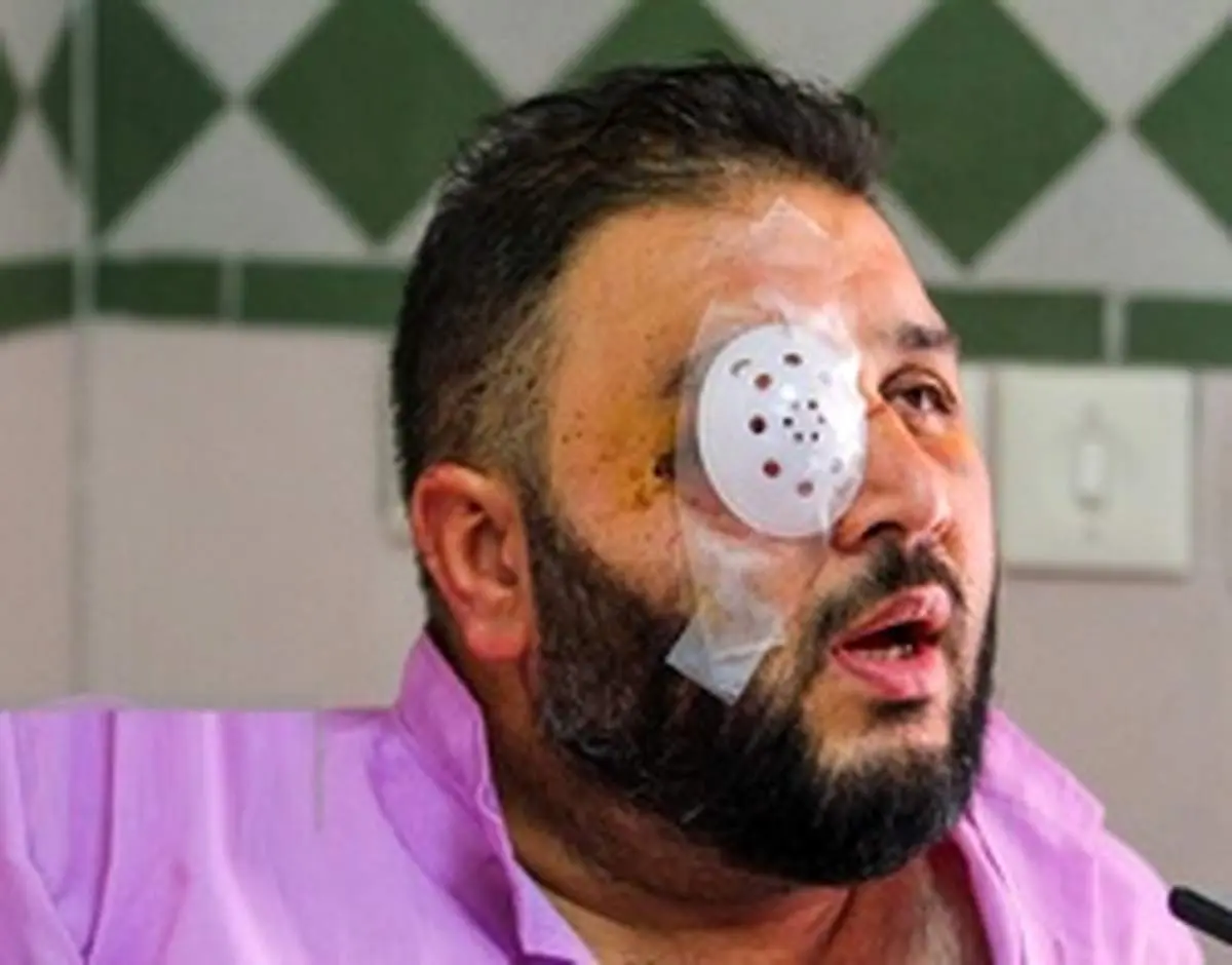 هوادار مصدوم پرسپولیس: دختر ۳ ساله‌ام با دیدنم ترسید