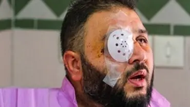 هوادار مصدوم پرسپولیس: دختر ۳ ساله‌ام با دیدنم ترسید