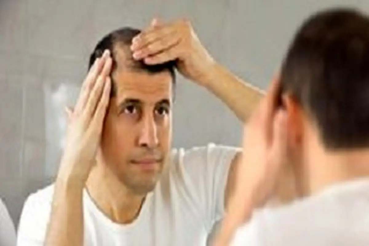 شناخت دلایل پنهان ریزش مو و روش‌های درمان ریزش مو