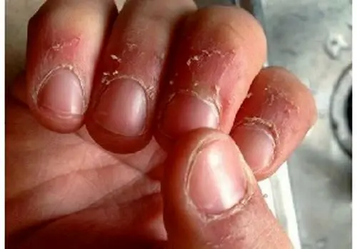 این ویتامین‌ ها نقش بسیار مهمی در زیبایی و رشد ناخن‌ ها دارند!