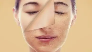 علت زردی پوست و رنگ پریدگی چهره ام چیست؟ همیشه انگار مریضم!