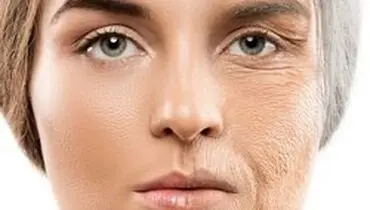 چرا زن‌ها زودتر از مرد‌ها پیر می‌شوند؟