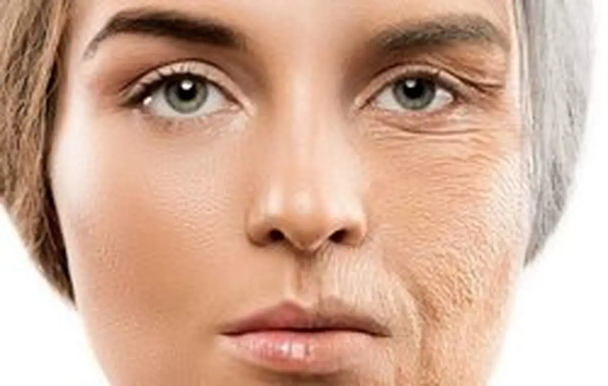چرا زنها زودتر از مردها پیر میشوند؟