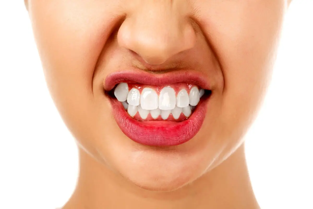 روش های طبیعی درمان دندان قروچه