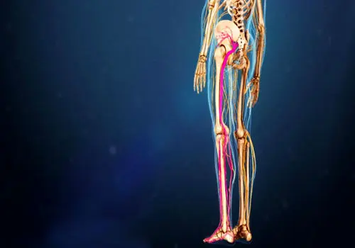 روش‌های سریع برای کاهش درد سیاتیک

