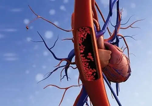 کنترل فشار خون با تغذیه؛ این ۴ غذا را روزانه بخورید