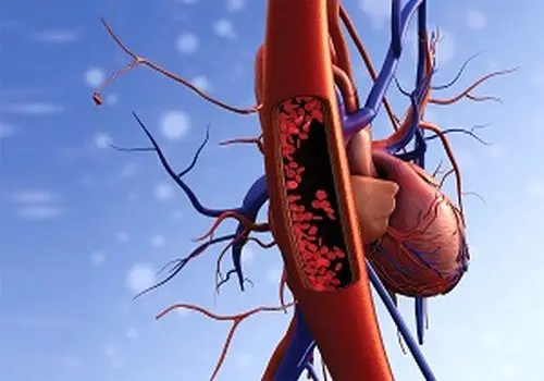 کنترل فشار خون با تغذیه؛ این ۴ غذا را روزانه بخورید