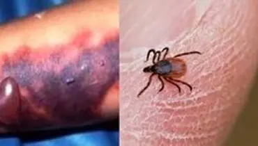 خطر ابتلا به تب کنگو در ذبح غیربهداشتی دام
