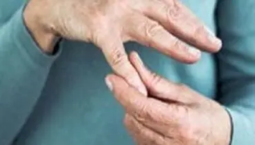 ۶ فعالیتی که به مقابله با آرتروز کمک می‌کنند