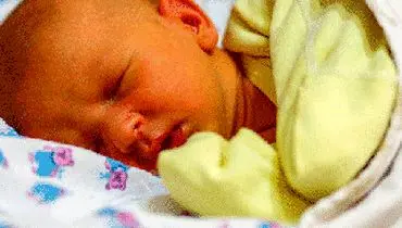 درمان زردی نوزاد با راهکار طب سنتی