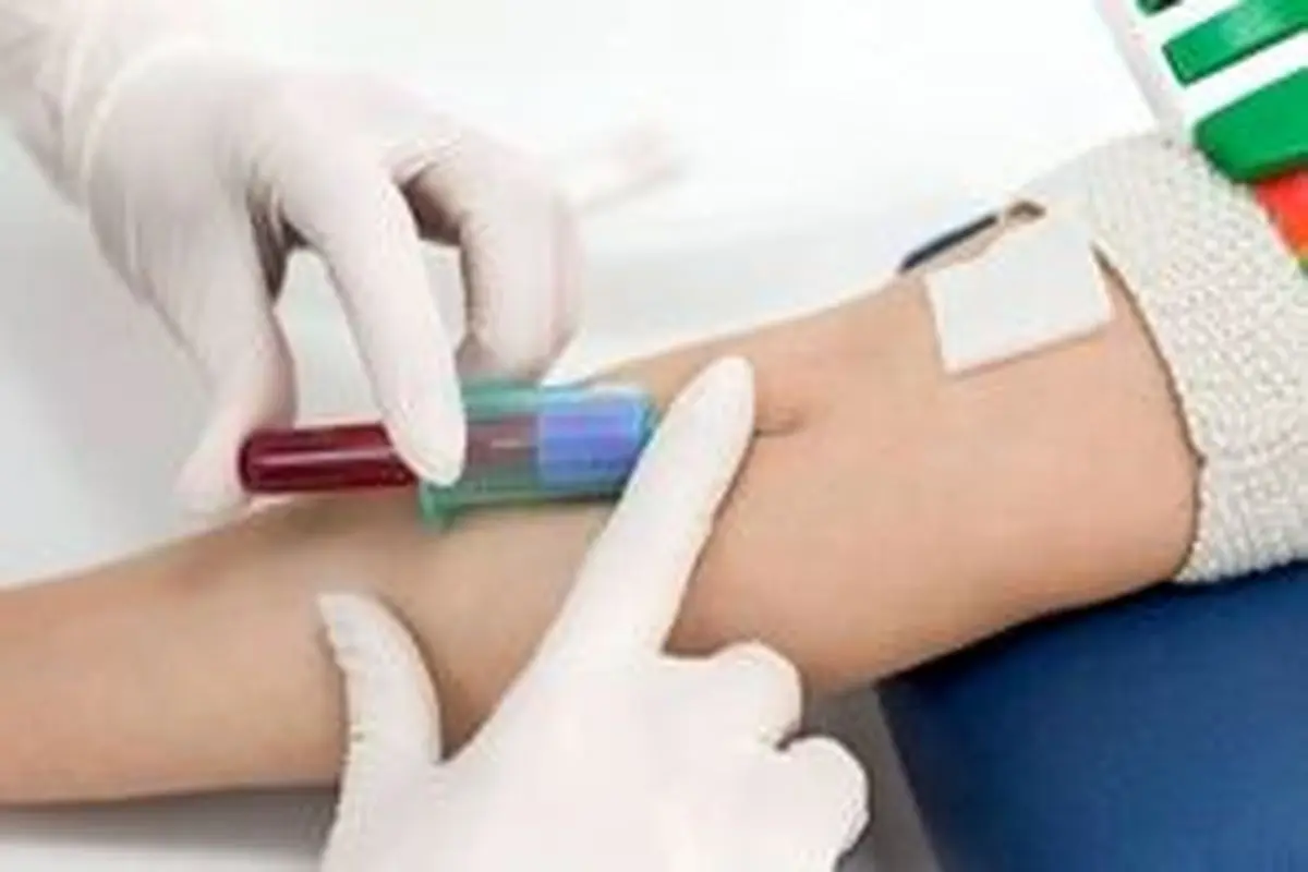 جواب آزمایش خون را چطور بفهمیم؟