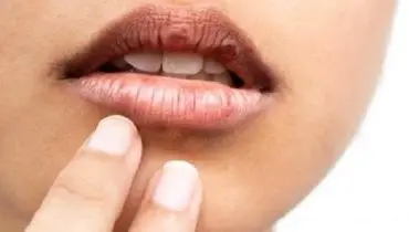 خشکی دهان را در خانه با 7 گام موثر از بین ببرید