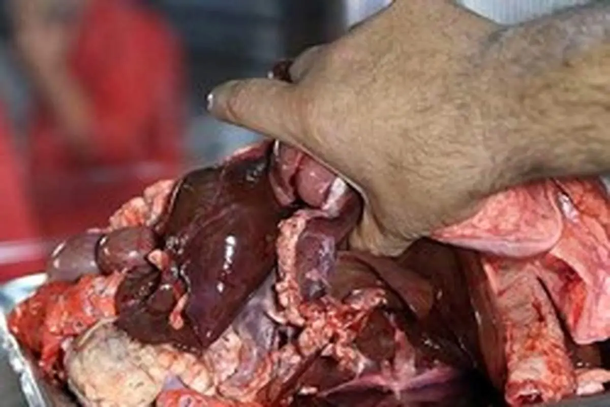 مرگ یک نوجوان به خاطر خوردن جگر