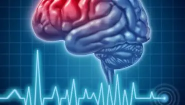 شایع‌ترین علل بروز سکته مغزی