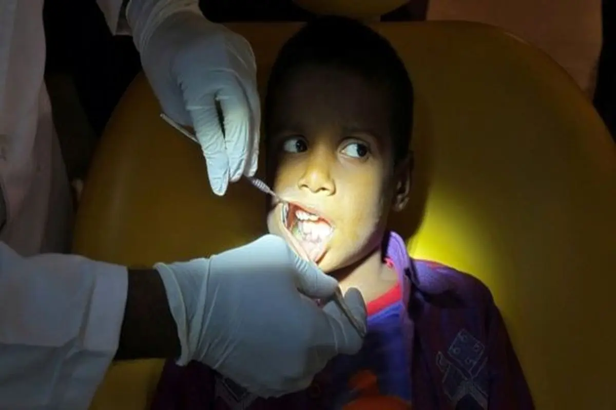 استخراج ۵۲۶ دندان از دهان پسربچه ۷ ساله!