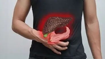 متهم اصلی ابتلا به کبد چرب از زبان فوق تخصص بیماری‌های گوارش و کبد