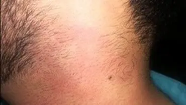 ضرب و شتم پرستار شیرازی توسط پزشک
