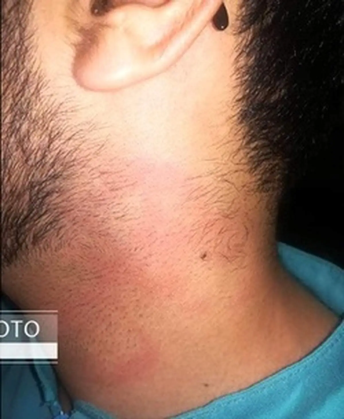 ضرب و شتم پرستار شیرازی توسط پزشک