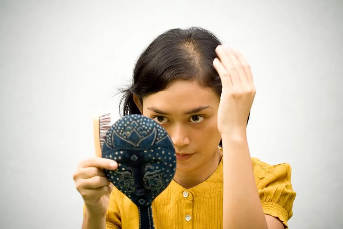 ۶ نشانه غیرعادی ریزش مو