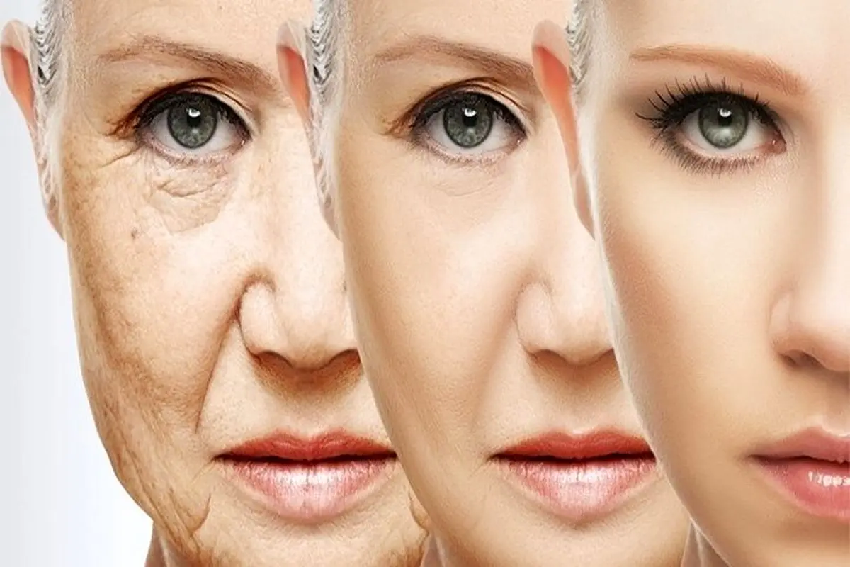 چرا پوست زود پیر می‌شود؟ ۹ علت، ۹ راهکار