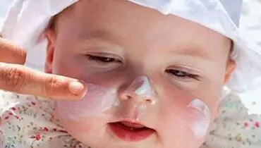 نکاتی برای مراقبت از اگزما در کودکان