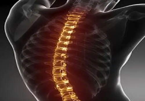 ۷ اشتباه خانگی که به ستون فقرات آسیب می‌زند