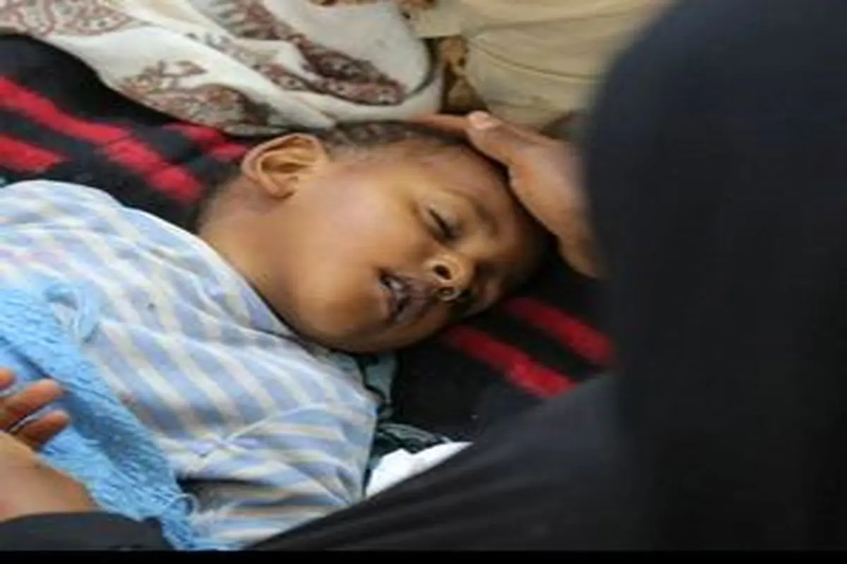 وبا در یمن ۷۷۳ قربانی گرفت