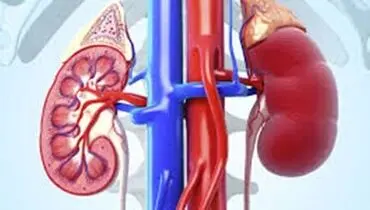 چه کسانی در معرض خطر ابتلا به سنگ کلیه هستند؟