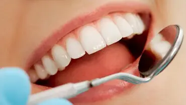 ۶ راهکار خانگی برای برق‌انداختن دندان مانند الماسی درخشان + علل تغییر رنگ