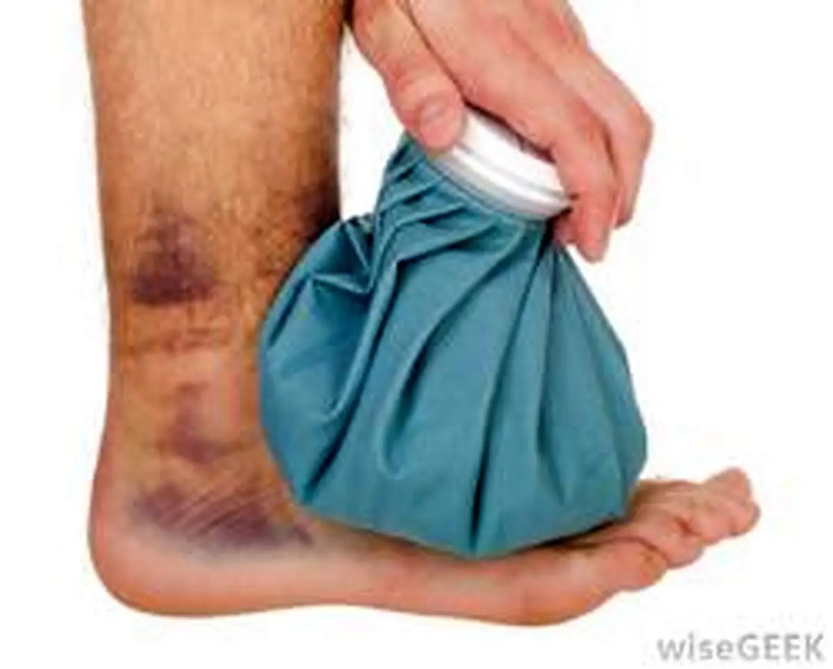 گرما یا سرما، کدام برای تسکین درد عضلات بهتر است؟