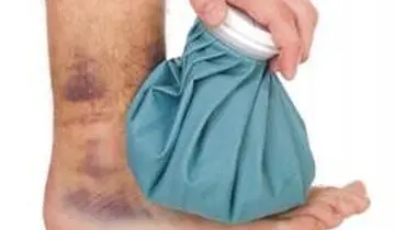 گرما یا سرما، کدام برای تسکین درد عضلات بهتر است؟