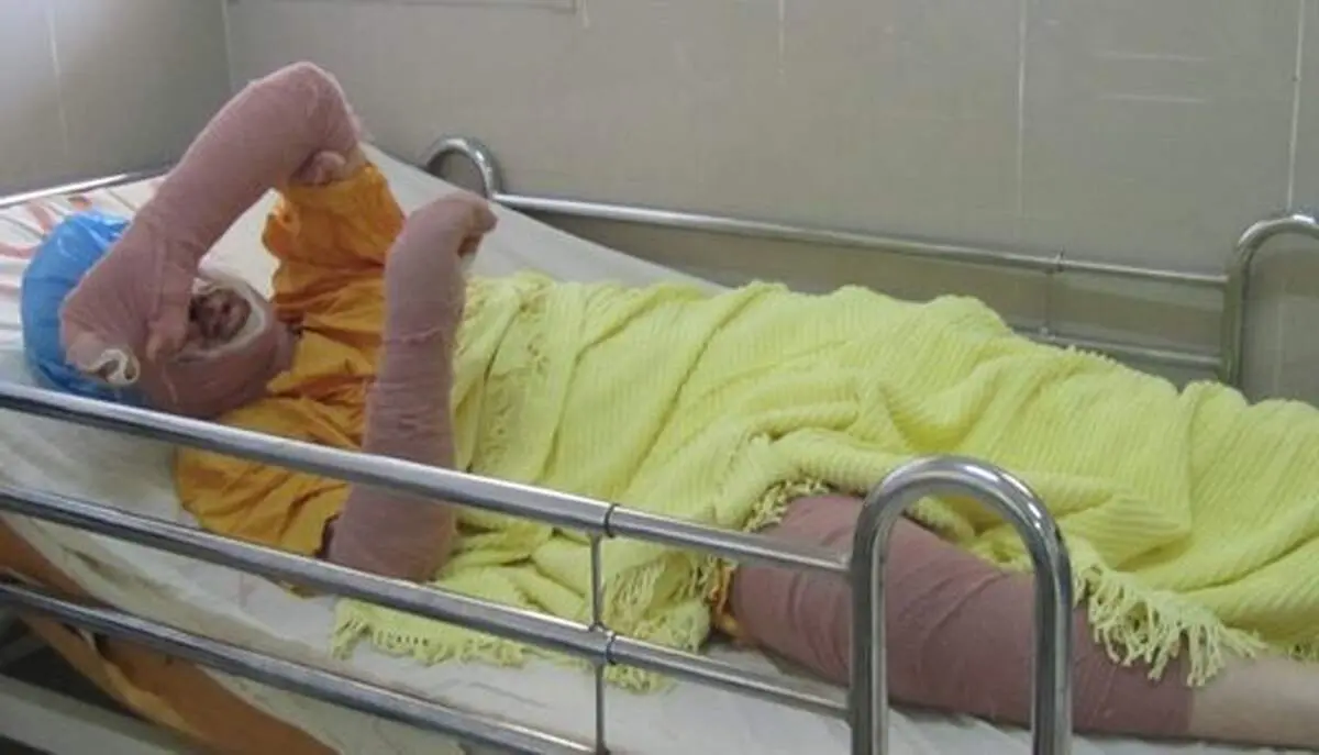 «دختر آبی» درگذشت