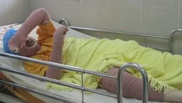 «دختر آبی» درگذشت