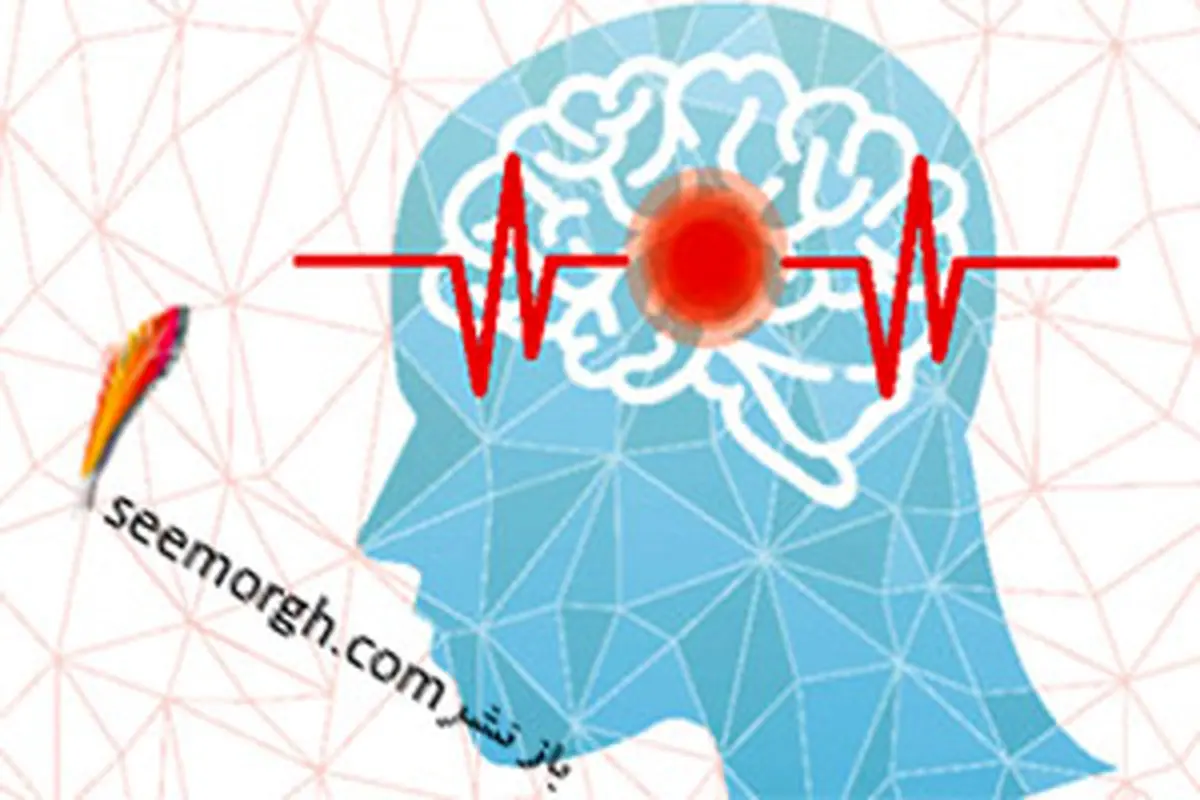 انواع سکته مغزی، سکته ایسکمیک و سکته هموراژیک