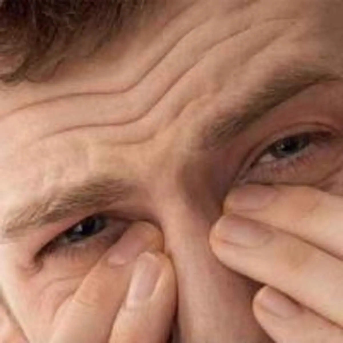 ۷ دلیل احتقان مزمن بینی