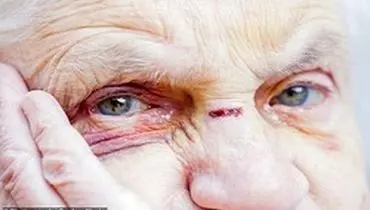 هزاران سالمند در انگلیس قربانی خشونت‌های خانگی