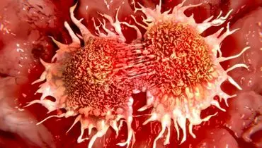 درمان سرطان با ۴ ملکول طلایی
