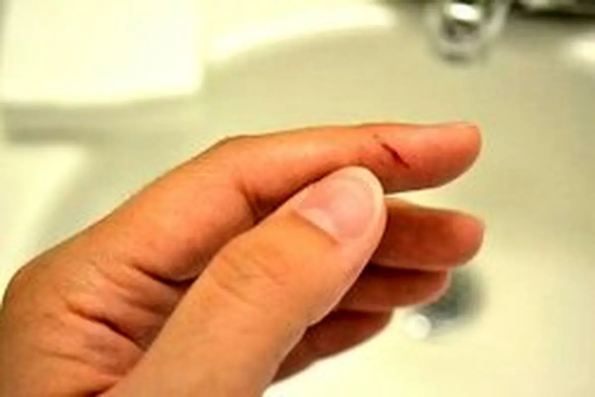 چرا بریدن انگشت با کاغذ اینقدر دردناک است؟