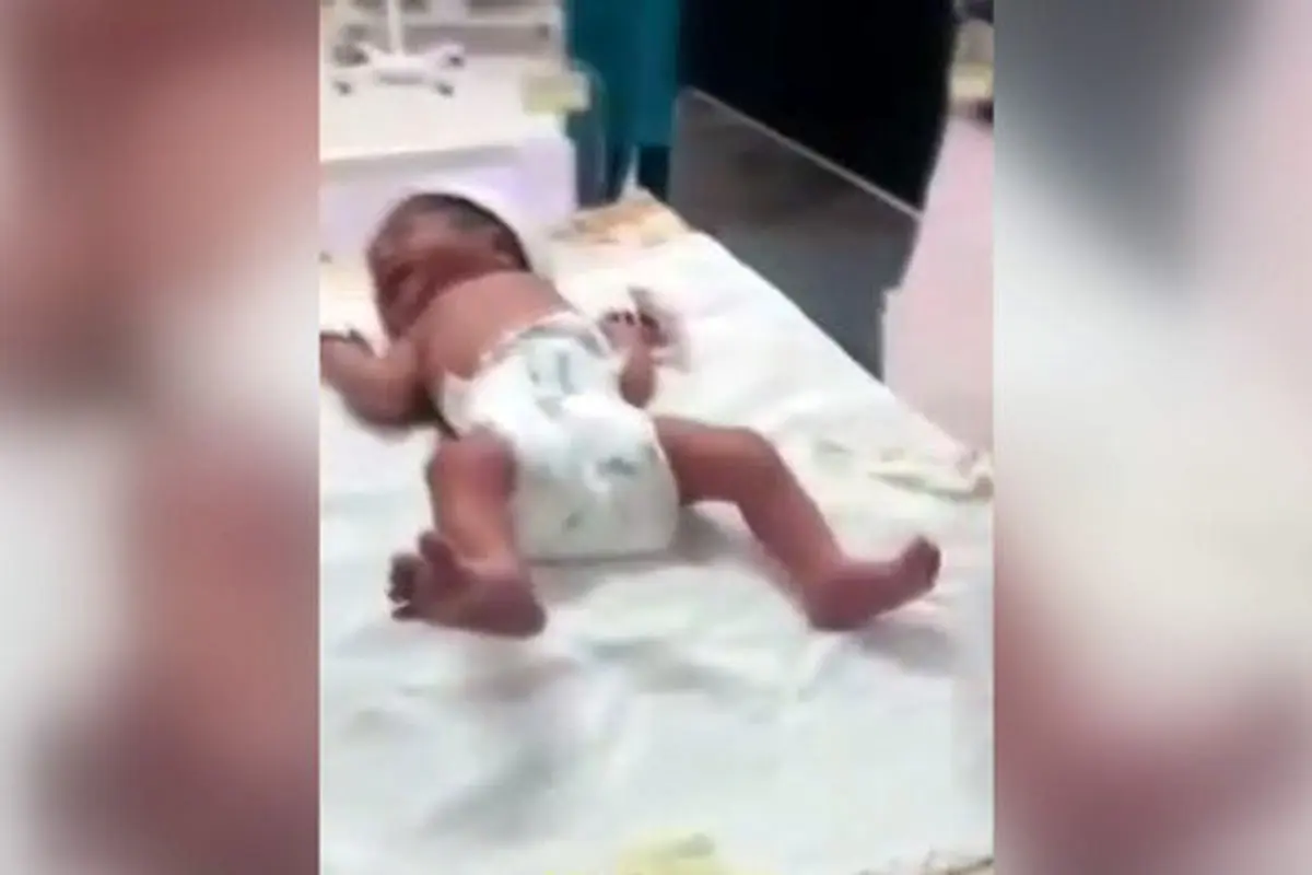 فیلم| قطع انگشت یک نوزاد در بیمارستان اطراف تهران