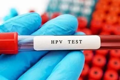 واکسیناسیون مهم‌ترین اقدام پیشگیرانه از این بیماری کشنده در دهانه رحم
