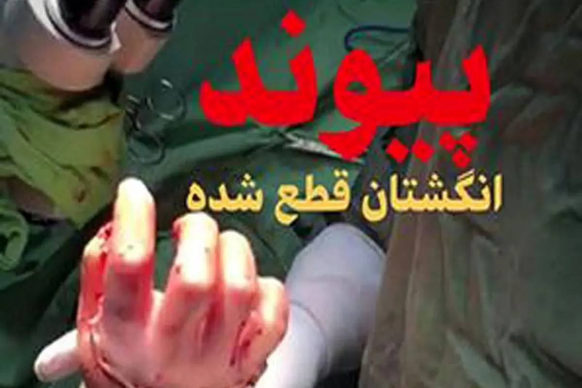 فیلم| مراحل پیوند دست قطع شده در شیراز (۱۴+)