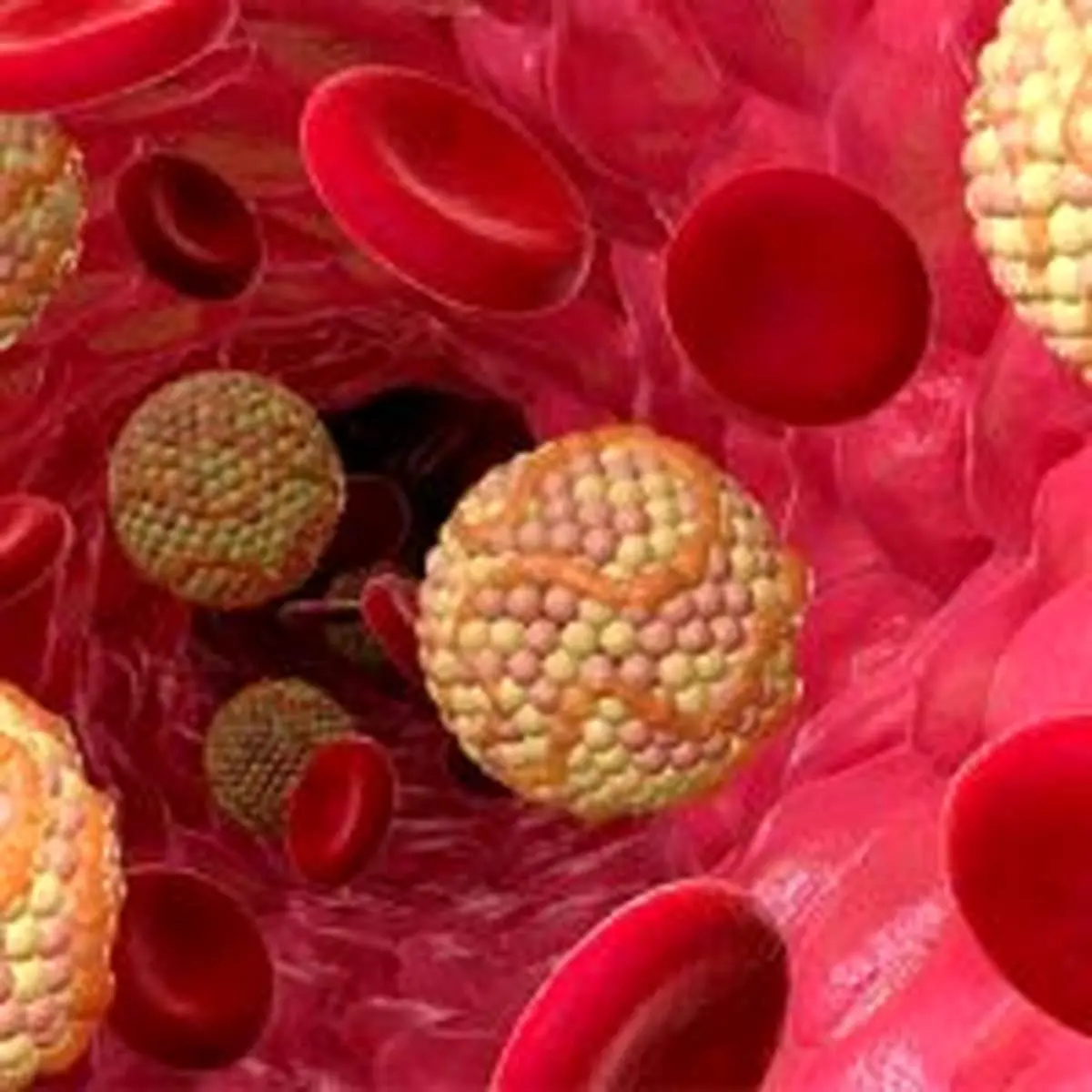 چه عواملی باعث ایجاد کلسترول بالا میشوند؟