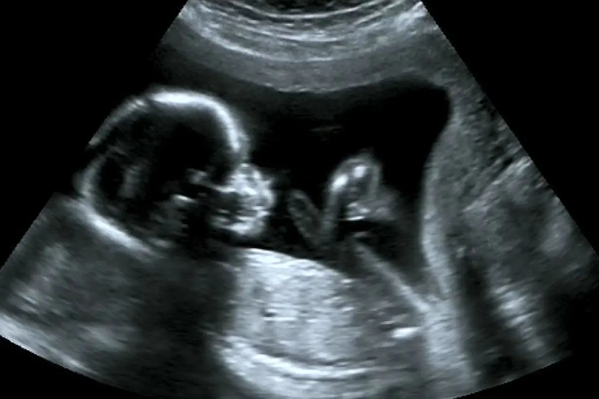 عجیب‌ترین حقایق دوران بارداری؛ از تمرین احساسات جنین پیش از تولد تا احتمال دوقلوزایی بیشتر در مادران قدبلند