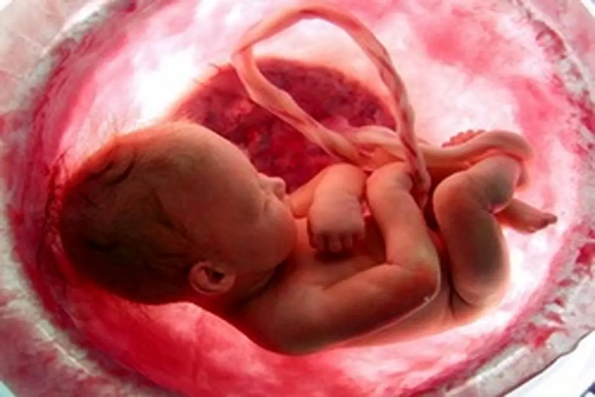قانون درباره‌ی سقط جنین چه می‌گوید؟