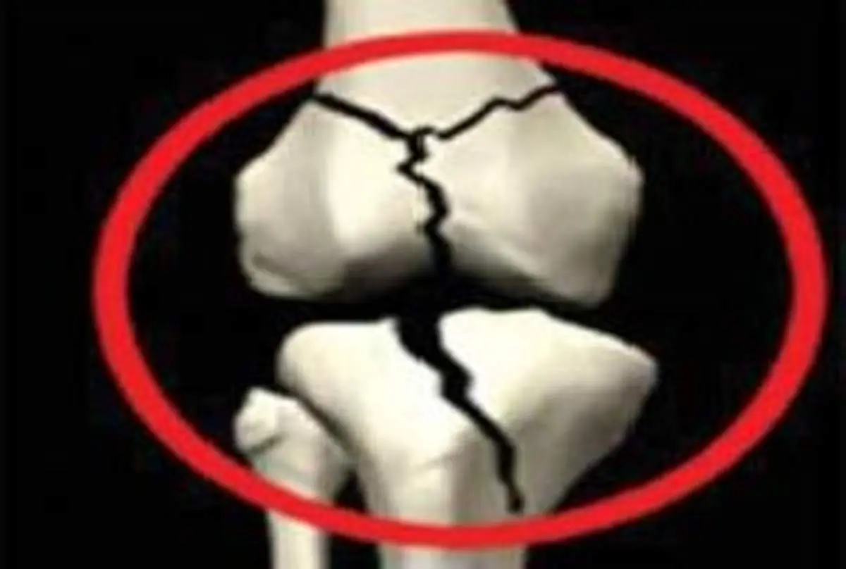 ماده غذایی مفید برای پوکی استخوان
