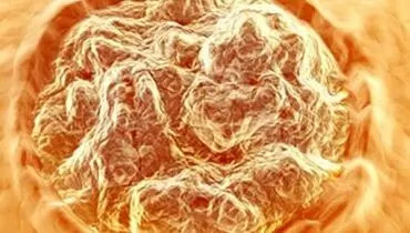 روش­های پیشگیری و درمان زگیل تناسلی