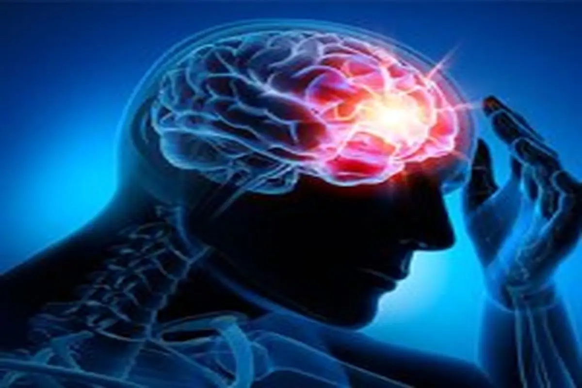 روش درمان و کاهش درد‌های ناشی از سکته‌های مغزی
