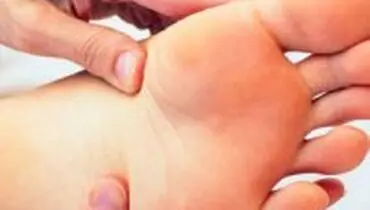۸ نکته برای کاهش سریع‌تر تورم پا