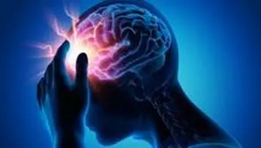 کاهش چشمگیر سن سکته مغزی در کشور