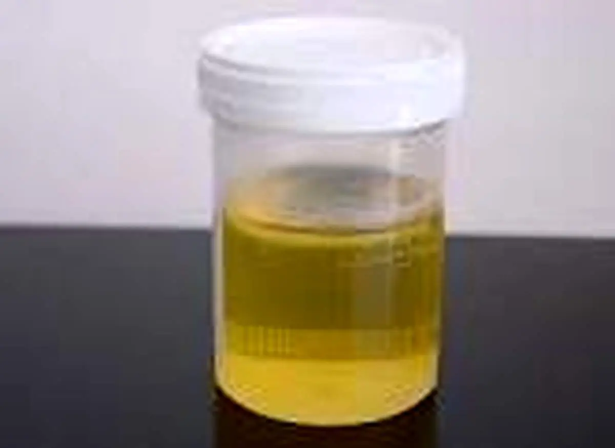 ۱۳ مقصر بالقوه بوی ناخوشایند و عجیب ادرار